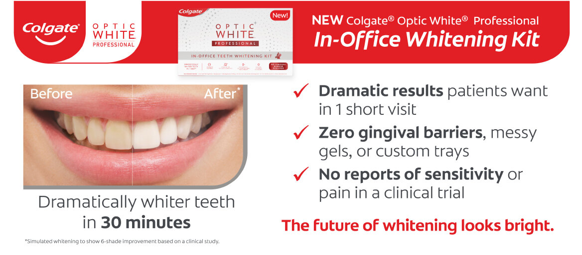 Colgate In-Office Whitening Kit