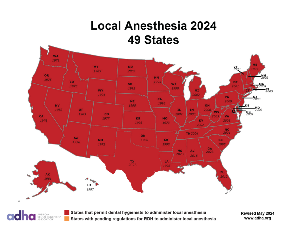 Map of U.S. states - Local Anesthesia 2024