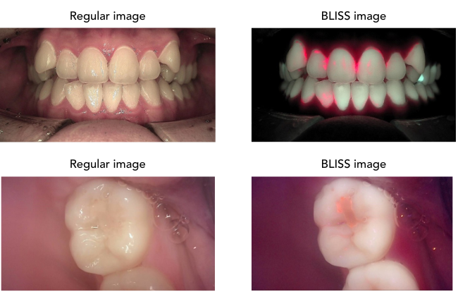 Four dental scan images