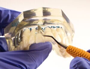 Gloved hands holding a maxillary typodont model upper and scaling an anterior implant