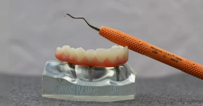 A dental instrument rests on a dental typodont model