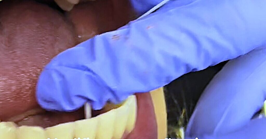 Jacy McKinney, RDH, wearing a mask and loupes, works on a reclined patient in a dental operatory.